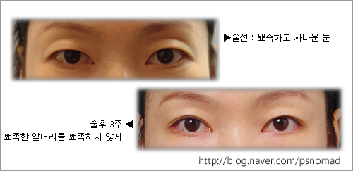 뭔가 모르게 눈의 느낌이 좋아졌어요