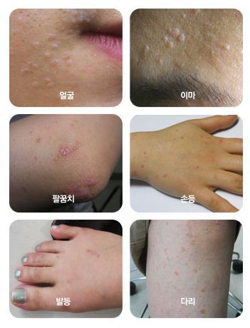 경희피치한의원 이미지