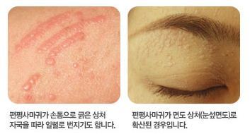 경희피치한의원 이미지