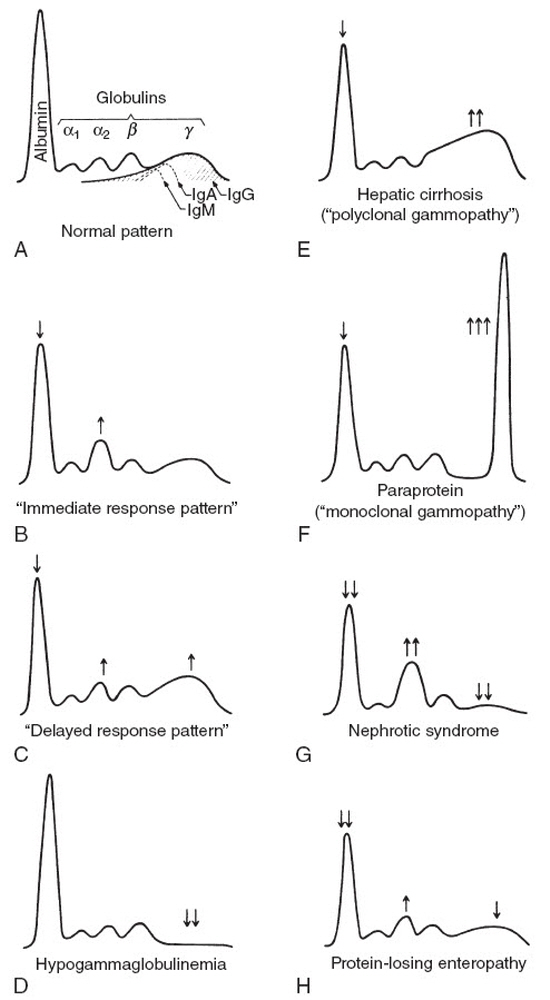 단백전기영동(Protein Electrophoresis) 네이버 블로그