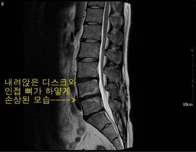 삼성바른신경외과 이미지