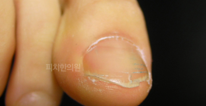경희피치한의원 이미지