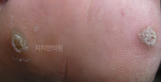경희피치한의원 이미지