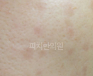 경희피치한의원 이미지