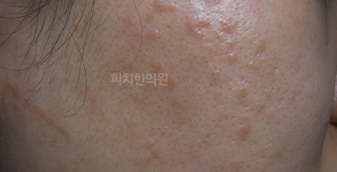 경희피치한의원 이미지