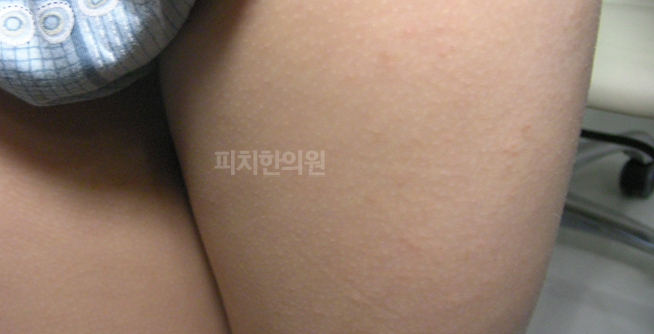 경희피치한의원 이미지