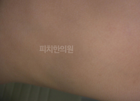 경희피치한의원 이미지