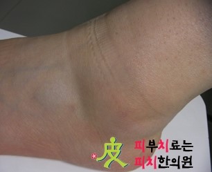 경희피치한의원 이미지