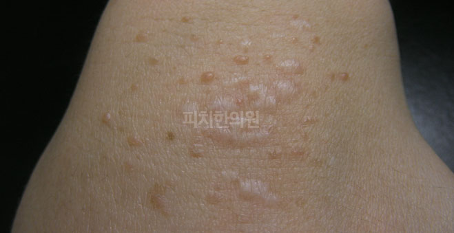 경희피치한의원 이미지