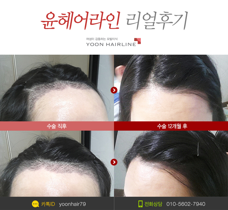 벨루스헤어 이미지