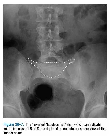 [영상의학] 비외상성 척추 X선 촬영과 퇴행성 질환 : 네이버 블로그