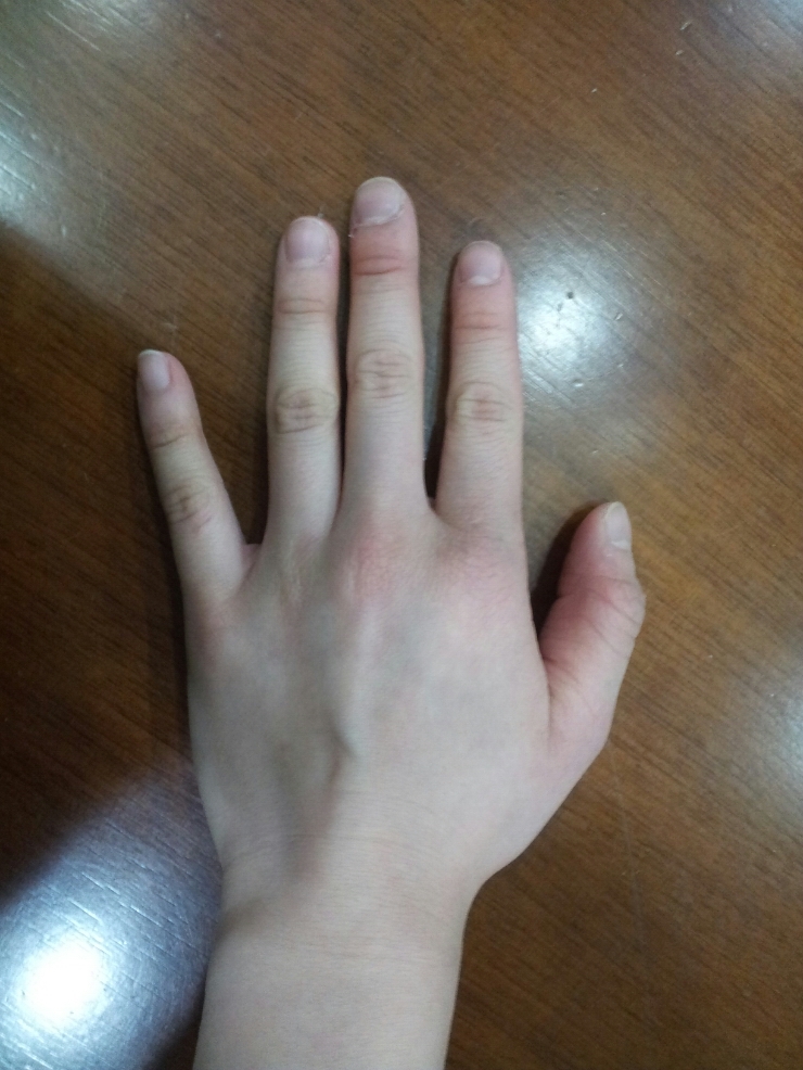 검지 약지 손가락 길이 차이의 비밀 : 네이버 블로그