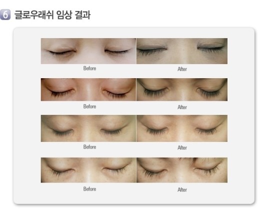 래쉬걸 이미지