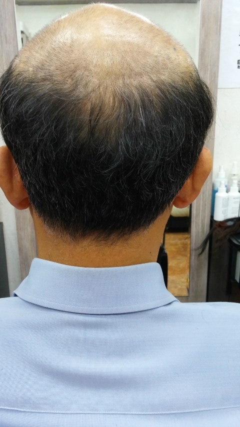 태경가발 이미지