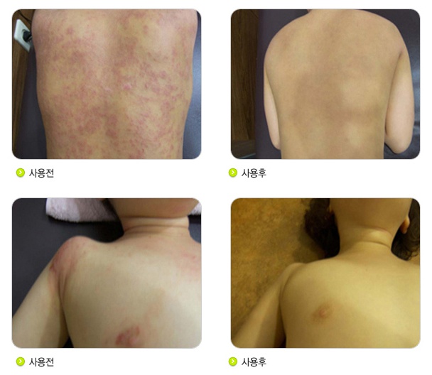 경희최한의원 이미지