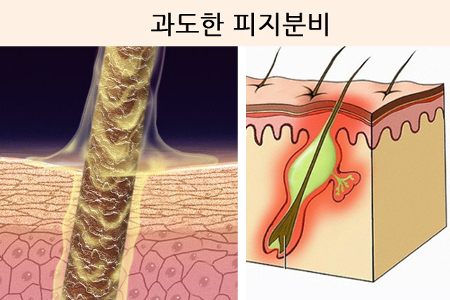 향기나는머리 이미지