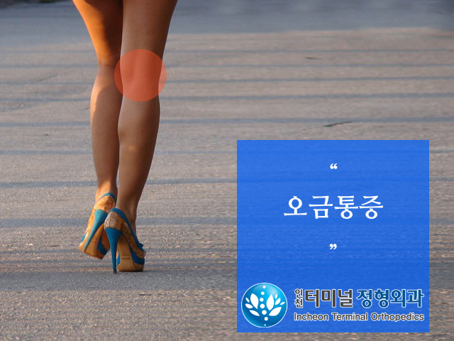 인천터미널정형외과_무릎 뒤 통증, 오금통증 : 네이버 블로그