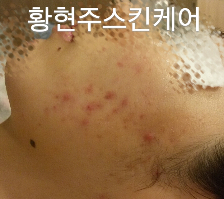 피디티 이미지