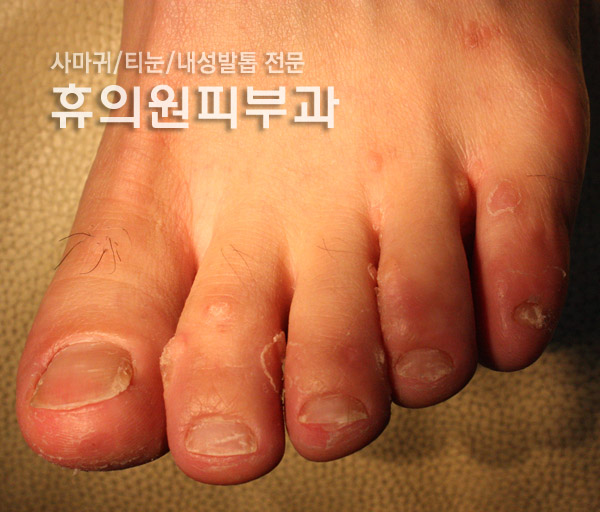 휴의원 이미지