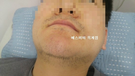 예스비비 이미지