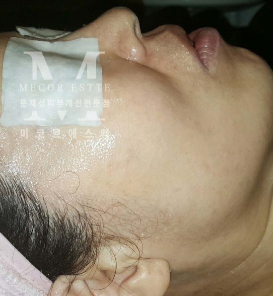 미케어셀 이미지