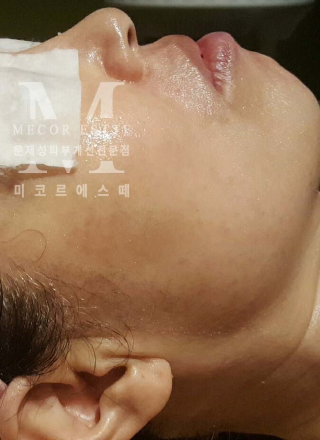 미케어셀 이미지
