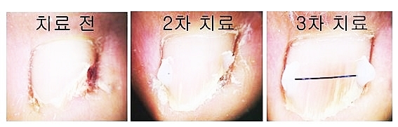 물빛피부과 이미지