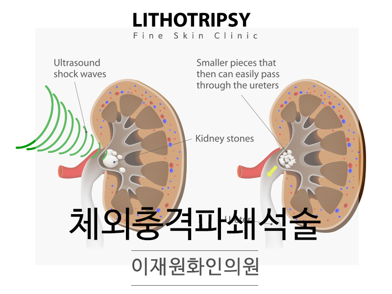 이재원화인의원 이미지
