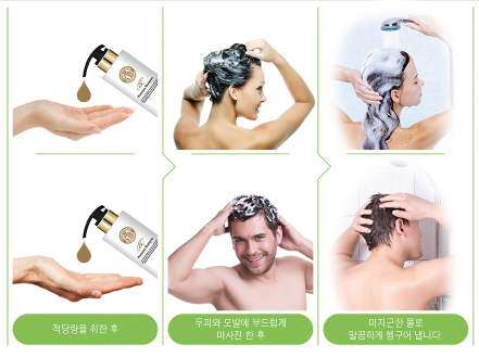 탈모야놀자 이미지