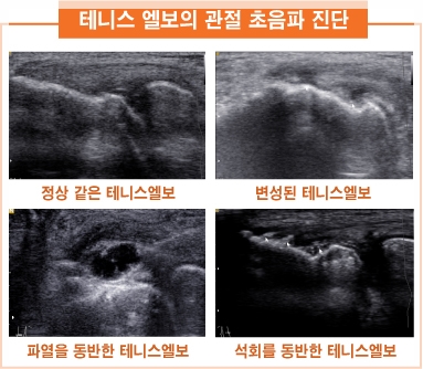 스윗피티샵 이미지