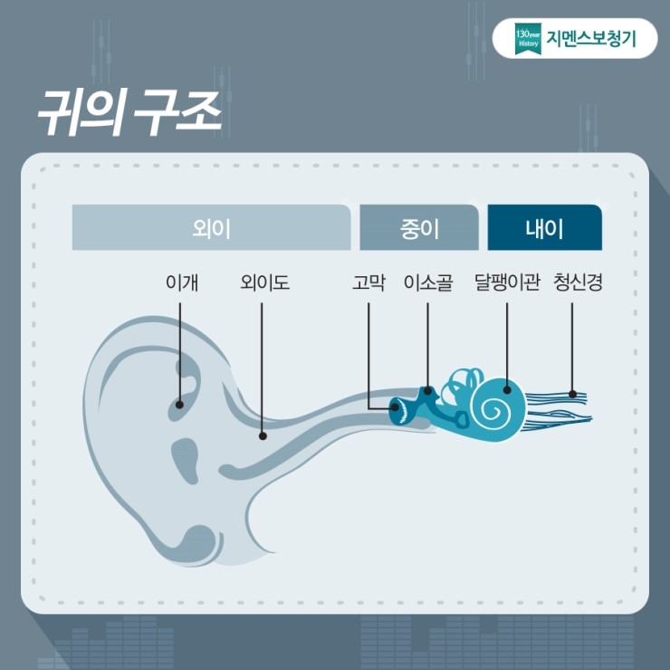우리독일보청기 이미지