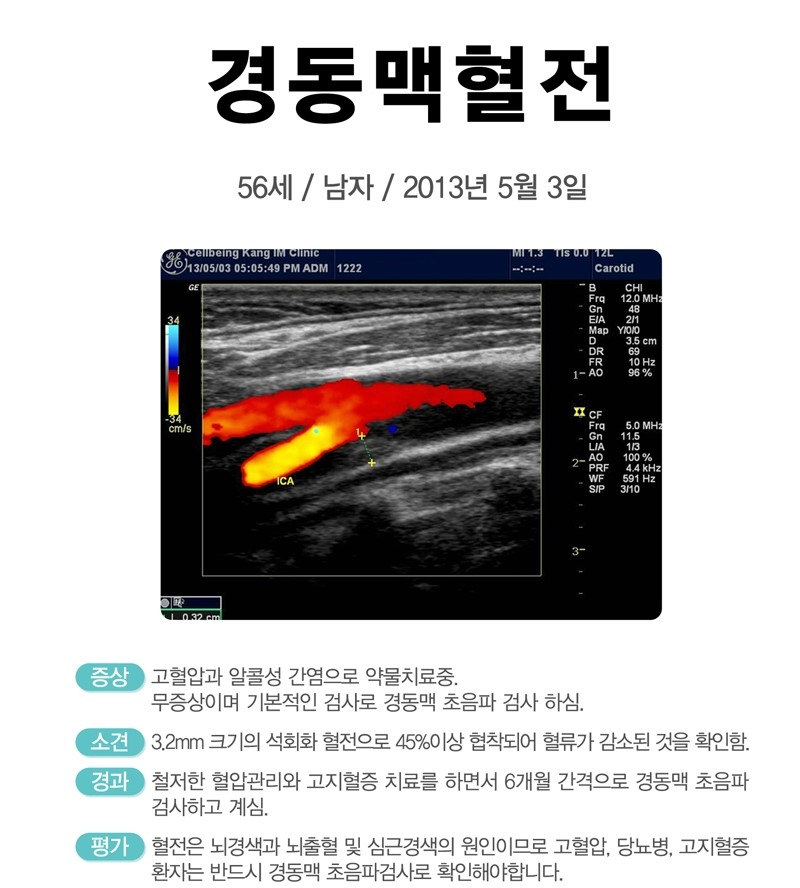 셀빙강내과의원 이미지