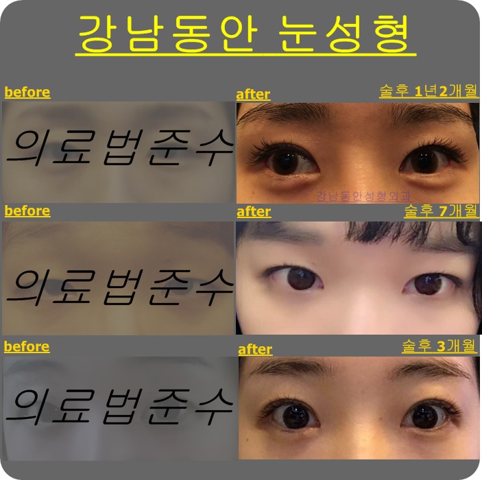 지디에스 이미지