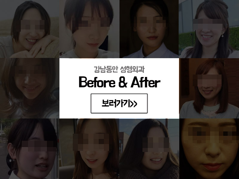 지디에스 이미지