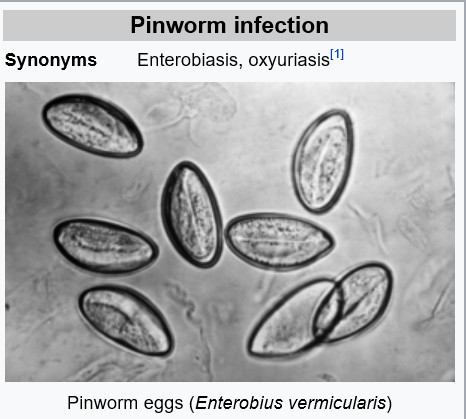 Enterobiasis(요충증, Pinworm Infection) : 네이버 블로그