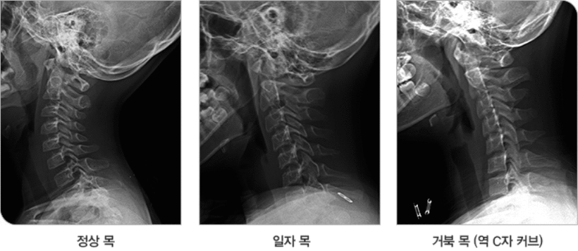 더디스크 이미지