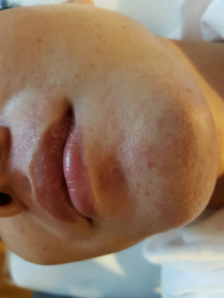 초이샵 이미지