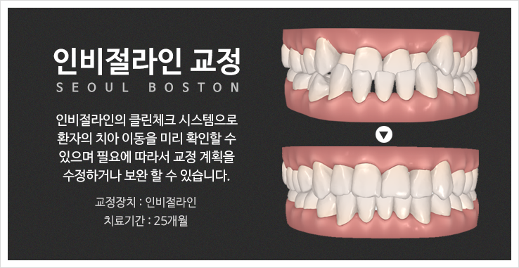 서울보스턴치과 이미지