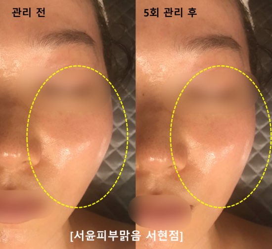 피부,맑음 이미지