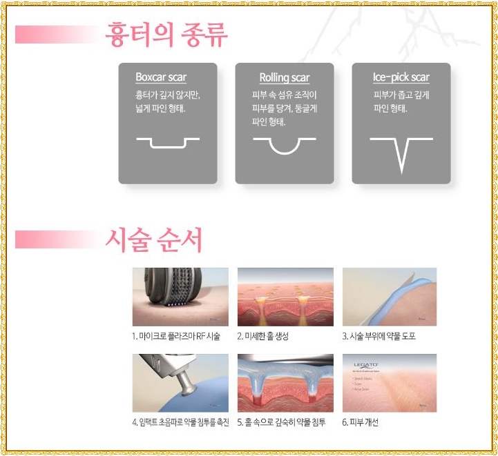 레가토 이미지