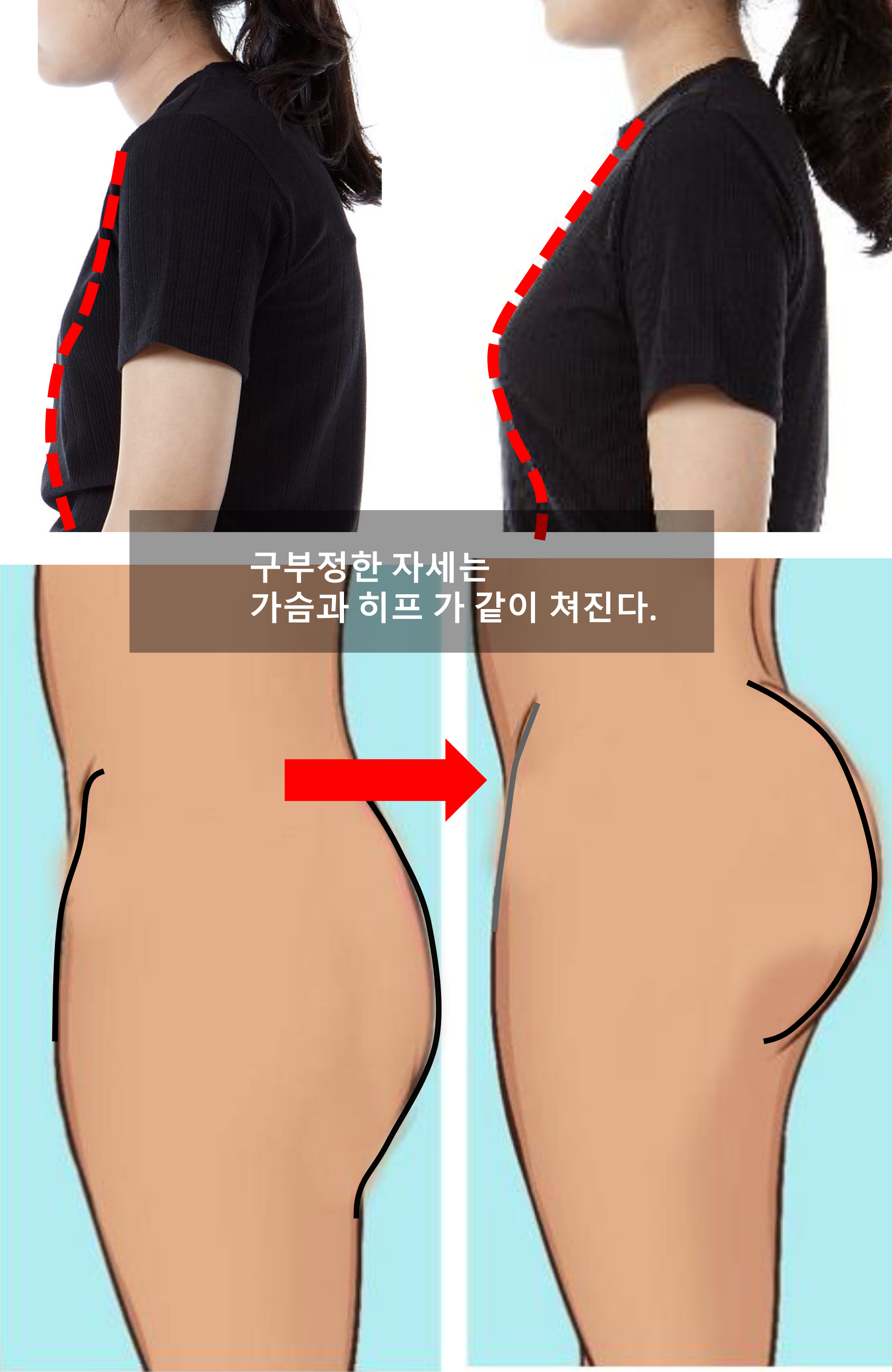 예쁜걸음 이미지