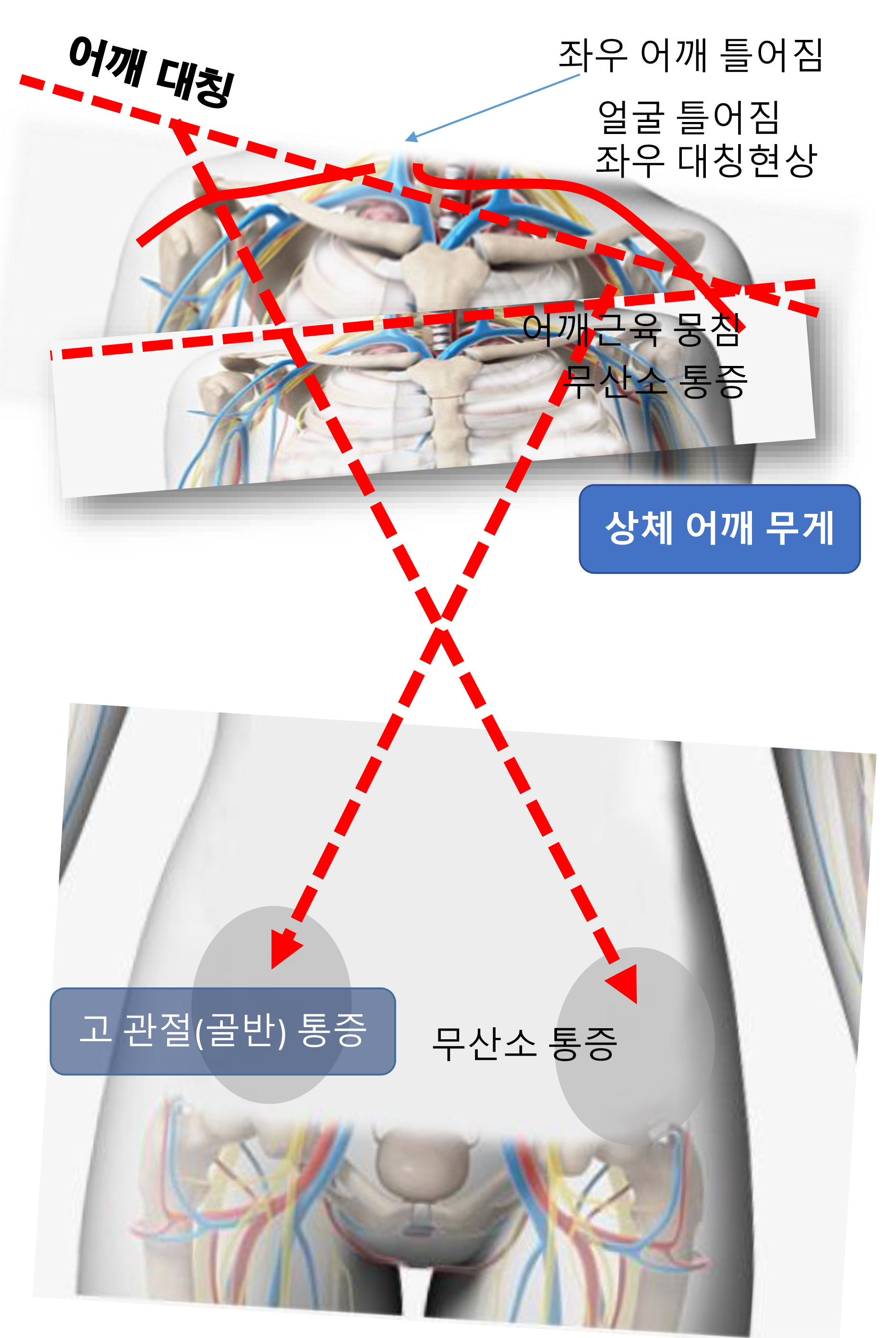 예쁜걸음 이미지