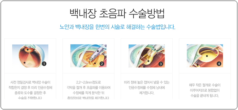 눈사랑안과 이미지