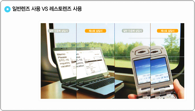 눈사랑안과 이미지