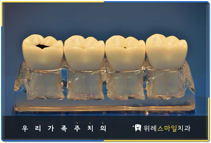위례스마일치과 이미지