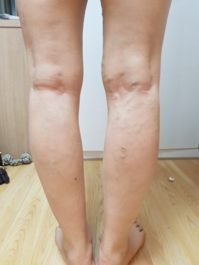 어싱브레인 이미지