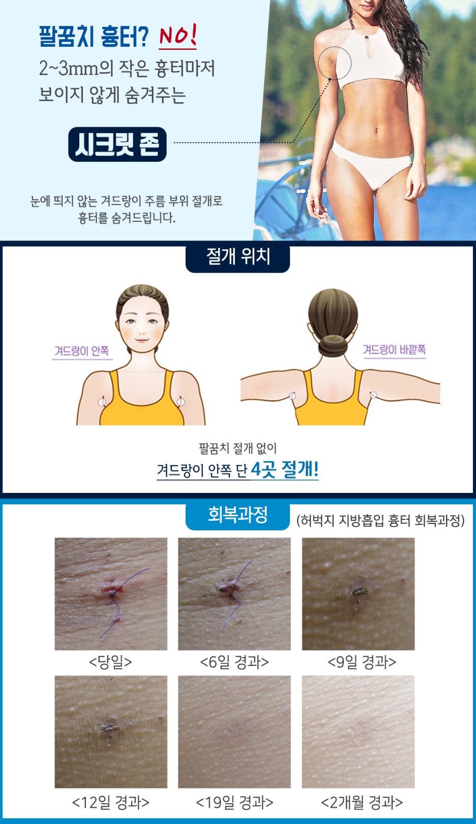 강남더슬림의원 이미지