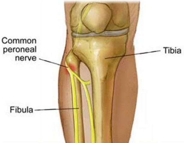 Common Peronial Innervation common peroneal nerve / superficial peroneal(superficial peroneal ...