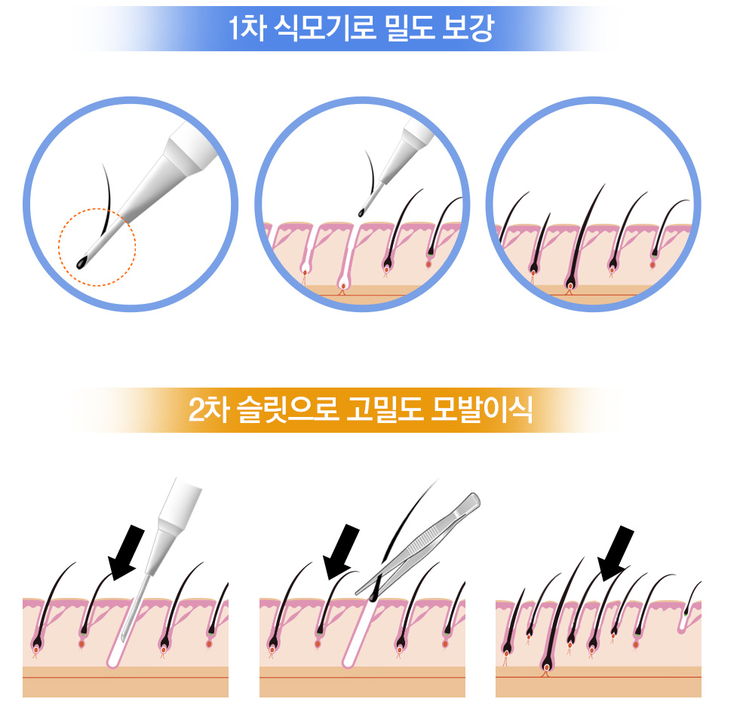히트성형외과의원 이미지