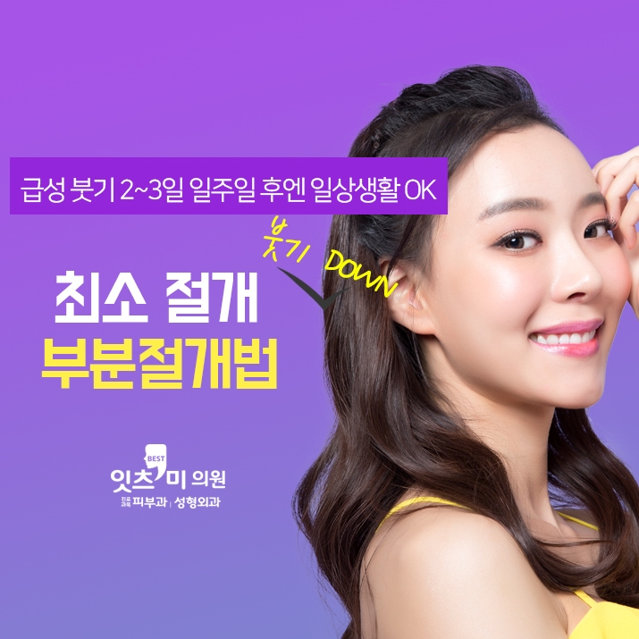 잇츠미 이미지